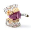 Dental Saliva Suction Bite Block Easyinsmile Silicone Autoclavable-5